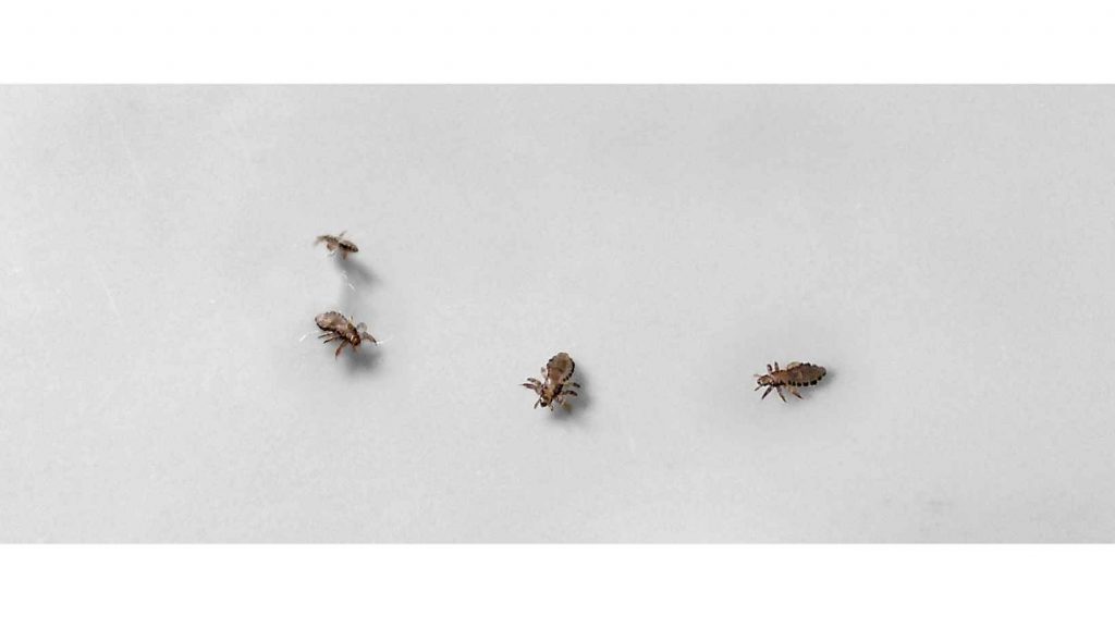 Can Head Lice Live On Pillows? Cosy Sleep